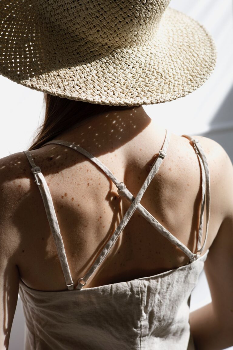 A bőrünk nem felejt! – Minden, amit az anyajegyekről tudnod kell Remind magazin