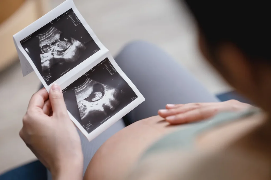 Pubertástól a menopauzáig: így változik a nők egészsége Remind magazin